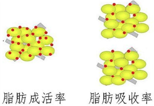 脂肪吸收?qǐng)D片