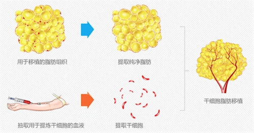 细胞填充图