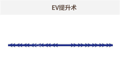 韓國歐佩拉整形雙重線圖