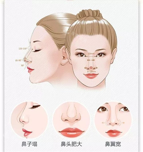 鼻部缺陷對(duì)比示意圖 鼻部缺陷對(duì)比示意圖