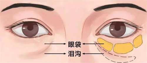 法令纹和泪沟特别重怎么办？教你一招和法令纹泪沟说拜拜