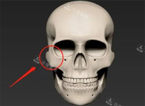 重庆潘宝华做磨骨怎么样？颧骨和下颌角手术后好看吗？