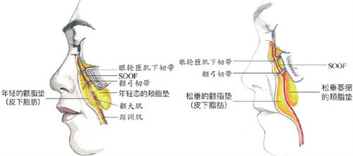 拉皮手术皮肤组织图