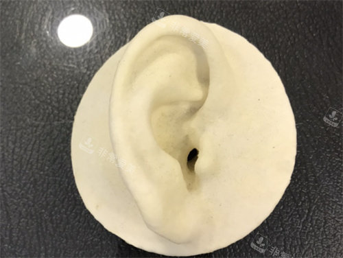韩国普罗菲耳整形耳朵模型图