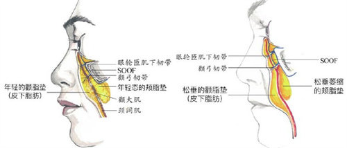 拉皮手术皮肤组织图