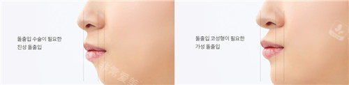 uverse鼻子美學(xué)設(shè)計(jì)圖 uverse鼻子美學(xué)設(shè)計(jì)圖