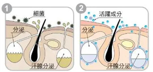 腋臭手术方法有哪些？腋臭手术会留疤吗？