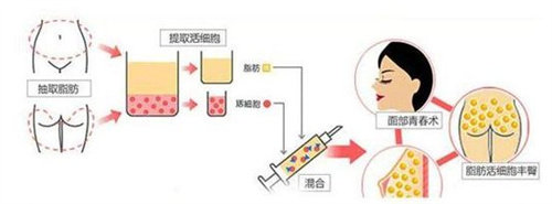 面部填充動畫流程圖