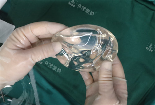 光面假体实例图 光面假体实例图