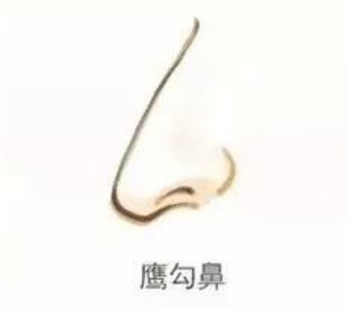 鷹鉤鼻示意圖 鷹鉤鼻示意圖