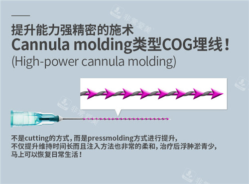 韓國美爾韓方醫(yī)院埋線提升術(shù)后圖線材介紹