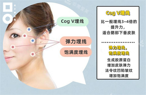 韓國美爾韓方醫(yī)院埋線提升介紹