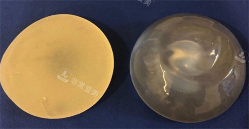 毛面假體與光面假體對(duì)比圖