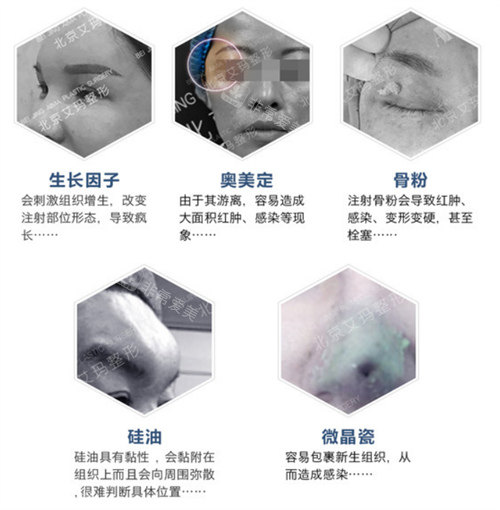 奧美定的類型