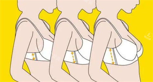 隆胸成效动画图 隆胸成效动画图