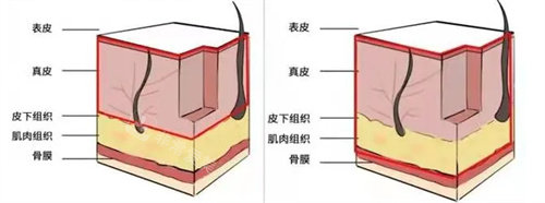 皮下组织图