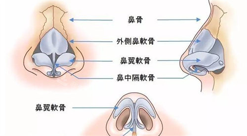 鼻部具体形态参考图