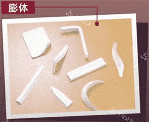 膨體假體示意圖 膨體假體示意圖