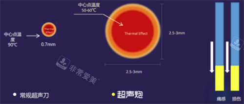 超声炮详情图