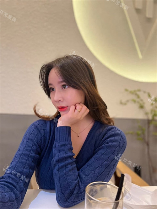 眼鼻吸脂術整形手術3周后照片 眼鼻吸脂術整形手術3周后照片