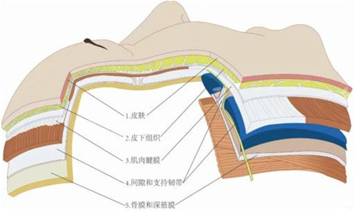 拉皮手術(shù)皮膚組織圖