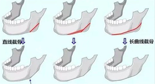 削骨直線和曲線圖片