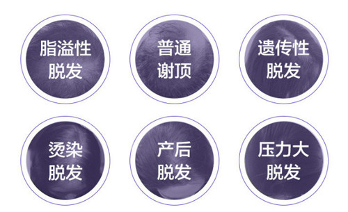 不同类型脱发 不同类型脱发