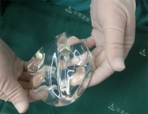 隆胸假體實(shí)際應(yīng)用圖 隆胸假體實(shí)際應(yīng)用圖