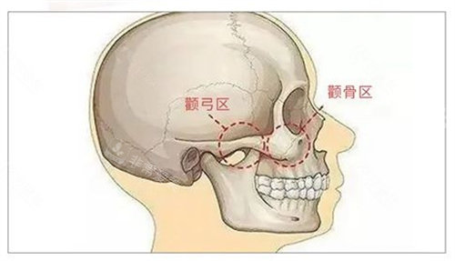 颧骨颧弓位置展示图
