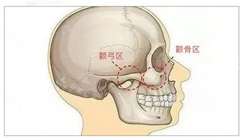 颧骨颧弓位置展示图 颧骨颧弓位置展示图