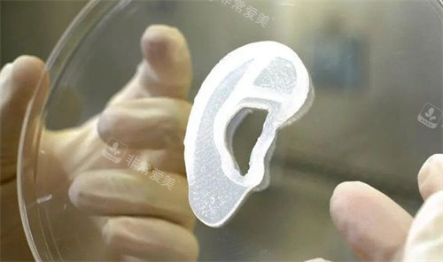 耳再造手術(shù)模型展示圖 耳再造手術(shù)模型展示圖