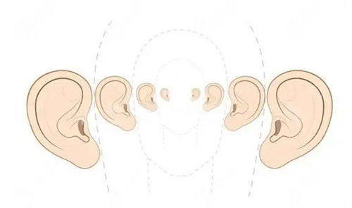 耳朵形态动画展示图