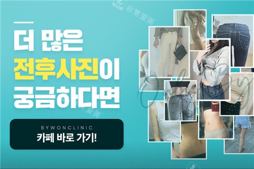 Bywon整形外科真人反饋 Bywon整形外科真人反饋