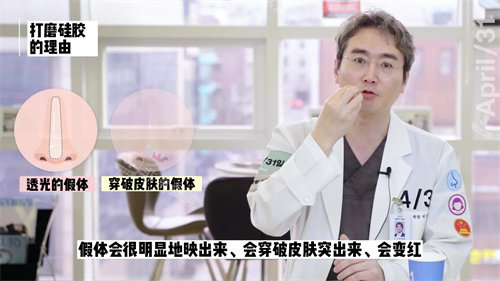 韓國431整形樸晟皖