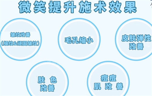 微笑提升的功效 微笑提升的功效
