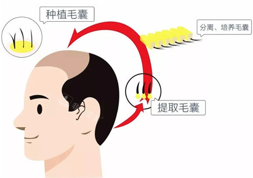 提取毛囊圖片 提取毛囊圖片