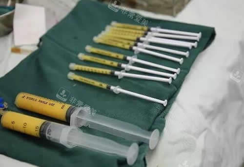 抽吸出來的脂肪照片 抽吸出來的脂肪照片
