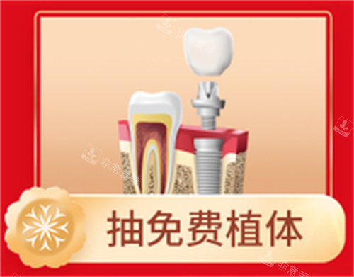 抽免費(fèi)植體活動(dòng) 抽免費(fèi)植體活動(dòng)