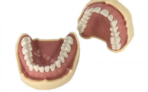 牙齿模型3D打印图