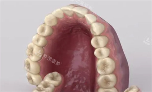 牙齒變色發(fā)黃動畫圖