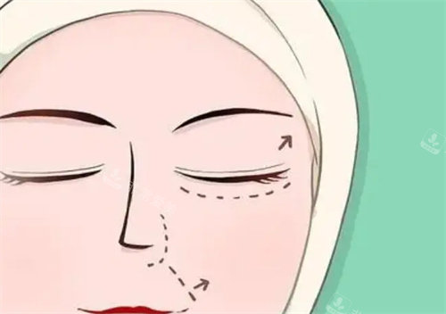 眼部整形动画图 眼部整形动画图