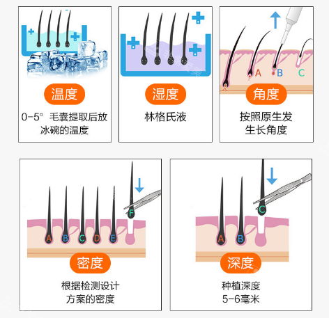 影响毛发移植成效的因素