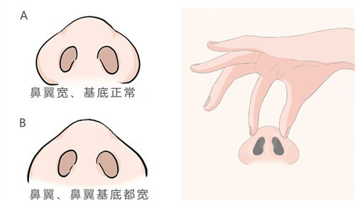 鼻基底手术动画图