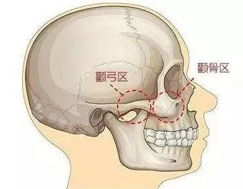 颧骨骨骼照片