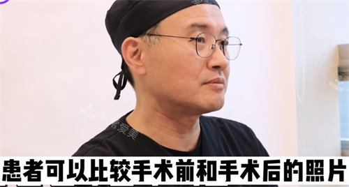 對(duì)比術(shù)前術(shù)后照片很重要