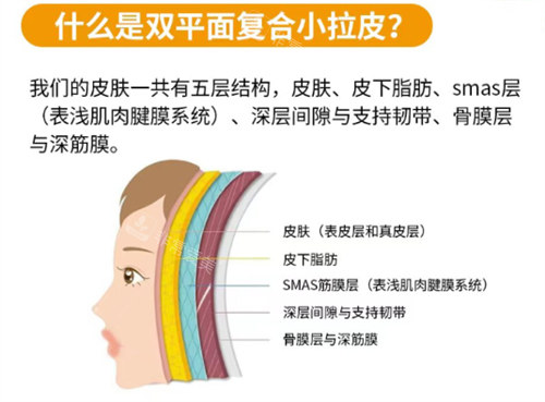 双平面符合小拉皮手术介绍 双平面符合小拉皮手术介绍