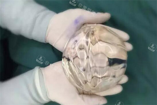 光面圓形假體參考圖 光面圓形假體參考圖