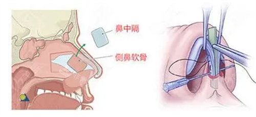 鼻子结构图