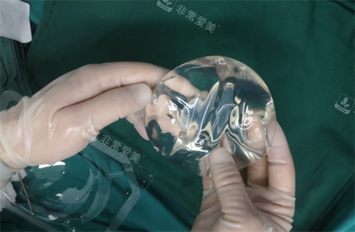 光面假體實例圖 光面假體實例圖
