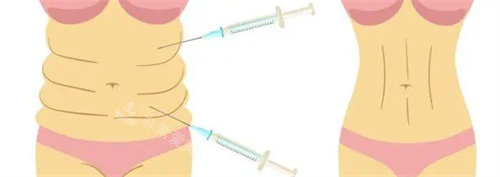 腰腹吸脂前后对比图